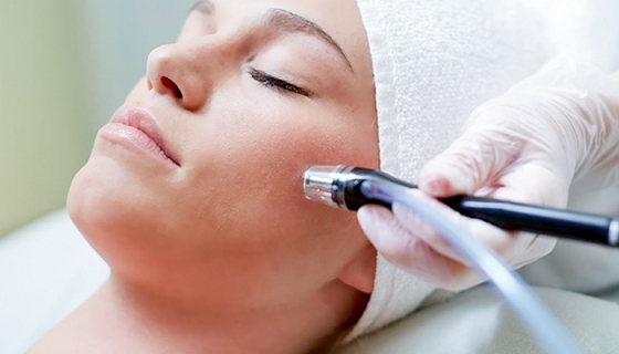 Microdermabrasion