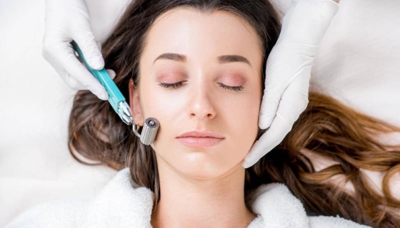 Microneedling 